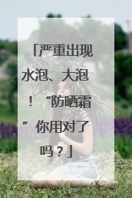 严重出现水泡、大泡！“防晒霜”你用对了吗？